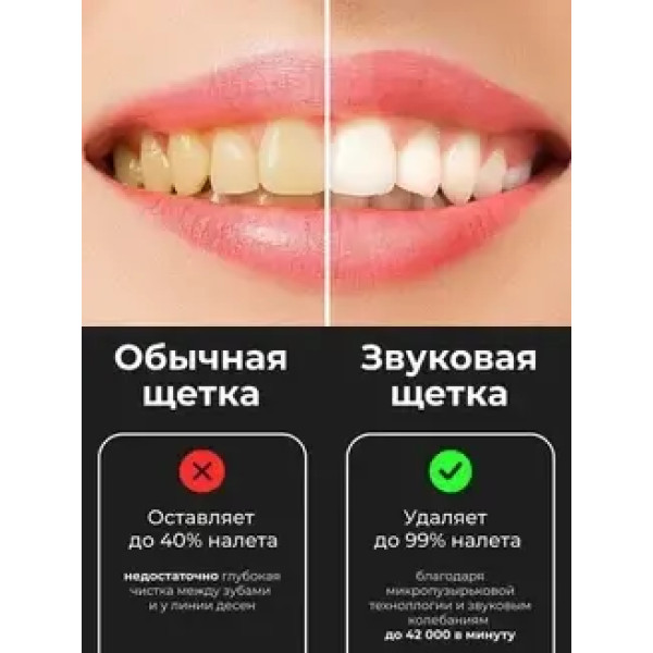 Электрическая зубная щётка Oulemei OLM-YS001